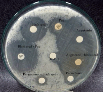 Image for - Synergism Between Nigella sativa Seeds Extract and Synthetic Antibiotics Against Mec A Gene Positive Human Strains of Staphylococcus aureus
