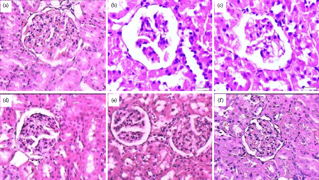 Image for - Effects of Candesartan and Losartan on Thioacetamide Induced Low Grade Renal Dysfunction in Rats