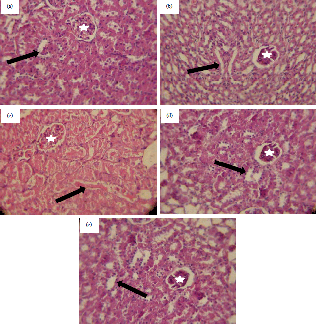 Image for - Prophylactic Effect of Diacerein against Cisplatin-Induced Nephrotoxicity in Rats