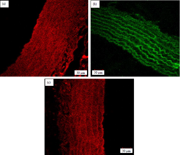 Image for - Inhibition of Adhesion Molecule Expression in Early Progression of Atherosclerosis in Dyslipidemia Model on Sprague Dawley Rats by Darapladib