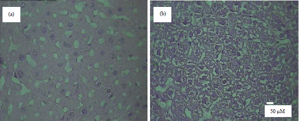 Image for - Hepatic Upregulation of Tumor Necrosis Factor Alpha and Activation of Nuclear Factor Kappa B Following Methyl Methacrylate Administration in the Rat