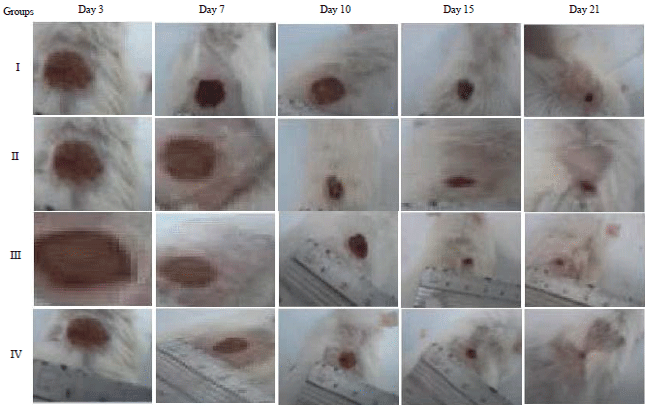 Image for - Biological Activity of Olive Leaf Extract and Regulation of Tissue Transglutaminase Expression in Diabetic Wound Healing