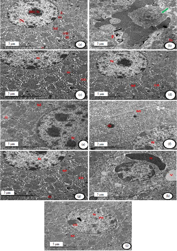 Image for - Synergistic Antioxidant Capacity of Chitosan Nanoparticles and Lycopene Against Aging Hepatotoxicity Induced by D-galactose in Male Rats