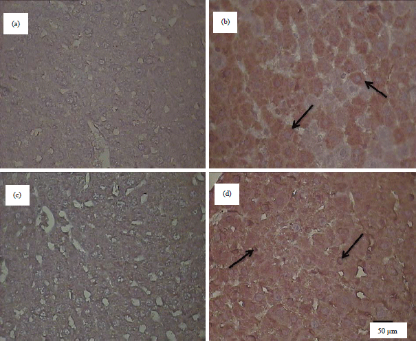 Image for - Hepatic Upregulation of Tumor Necrosis Factor Alpha and Activation of Nuclear Factor Kappa B Following Methyl Methacrylate Administration in the Rat