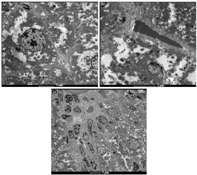Image for - Portal Fibroblast Role in Liver Fibrosis in Rats