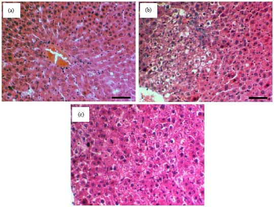 Image for - Ameliorative Effect of Mesenchymal Stem Cells-derived Exosomes on Diethylnitrosamine-induced Liver Injury in Albino Rats