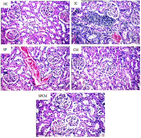 Image for - Nephroprotective Effect of Camel Milk and Spirulina platensis in Gentamicin-Induced Nephrotoxicity in Rats
