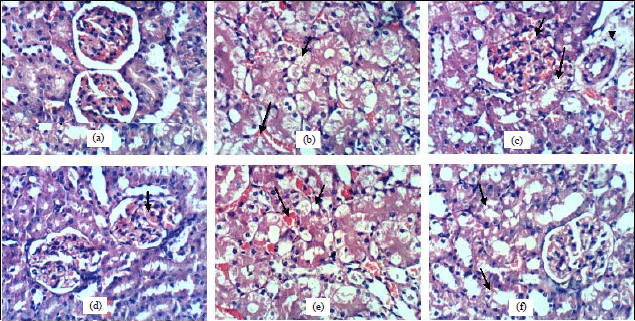 Image for - Protective Role of Aerial Parts of Silene villosa Alcoholic Extract Against CCl4-Induced Cardiac and Renal Toxicity in Rats