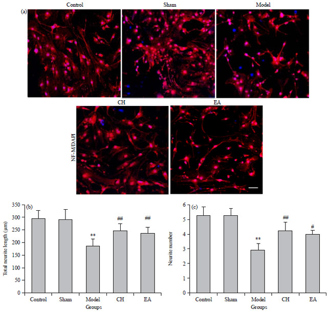 Image for - Electroacupuncture Rescued the Impairment of Hippocampal Neurons in Perimenopausal Depression Rats via Activating the CREB/BDNF Pathway