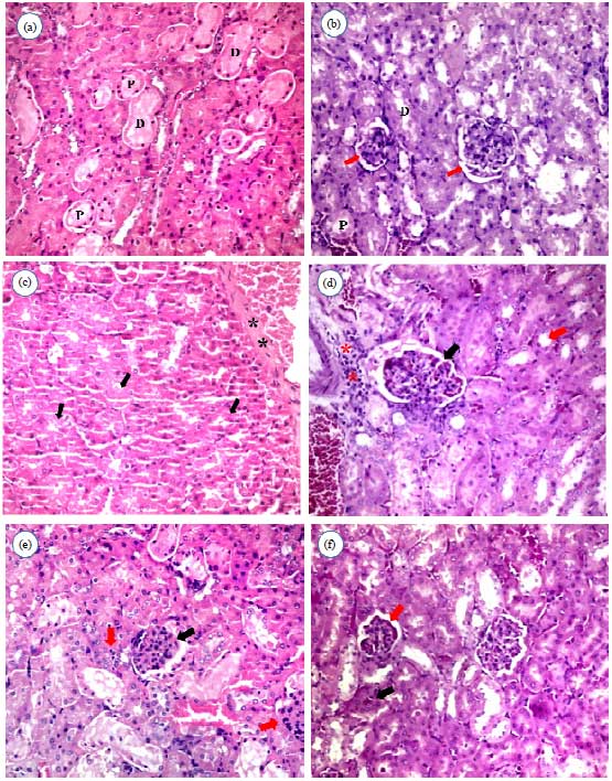 Image for - The Influence of L-carnitine on Aspartame Toxicity in Kidney of Male Rats
