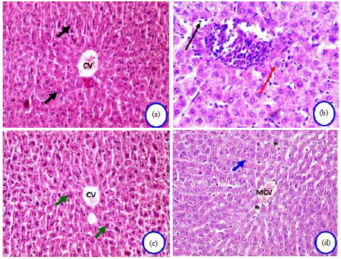 Image for - Antioxidant Effect of Carnosine on Aluminum Oxide Nanoparticles (Al2O3-NPs)-induced Hepatotoxicity and Testicular Structure Alterations in Male Rats