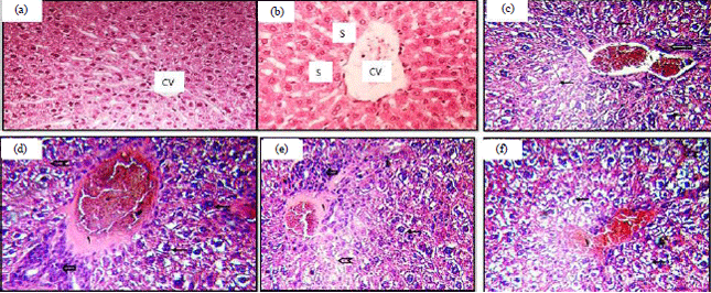 Image for - Histopathological Effect of Aspartame on Liver and Kidney of Mice