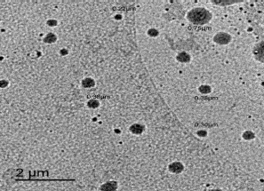 Image for - Fluconazole Nano-particles Loaded Gel for Improved Efficacy inTreatment of Oral Candidiasis