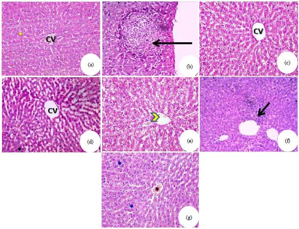 Image for - Antioxidant, Protective Effect of Black Berry and Quercetin Against Hepatotoxicity Induced by Aluminum Chloride in Male Rats