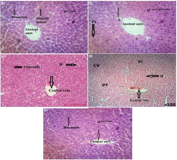 Image for - Protective Effect of Byrsonima sericea Extract on Non-alcoholic Fatty Liver Disease Model in Rats