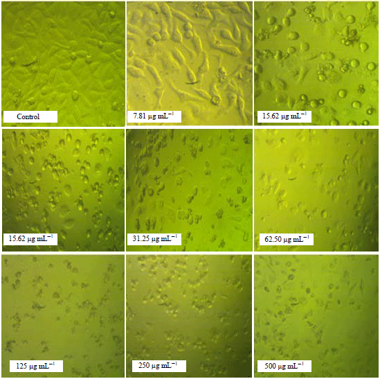 Image for - Cytogenetic Toxicity of Juniperus procera Extract with Silver Nanoparticles Against Carcinoma Colon (Caco2) Cell Line in vitro