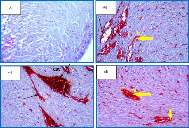 Image for - Histological and Histochemical Alternations in the Fetal HeartTissue of Maternal Prozac Exposure