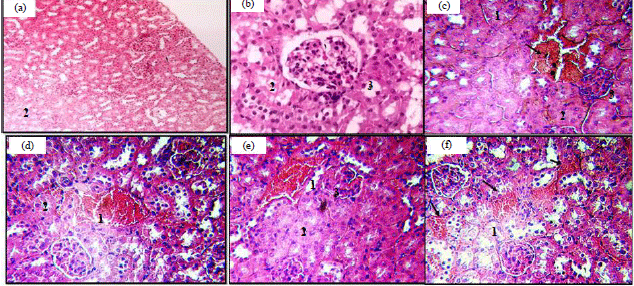 Image for - Histopathological Effect of Aspartame on Liver and Kidney of Mice