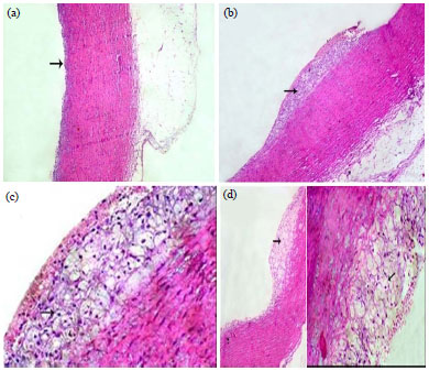 Image for - Effect of Flaxseed on Lipid Profile, Antioxidants and PPAR-α Gene Expression in Rabbit Fed Hypercholesterolemic Diet
