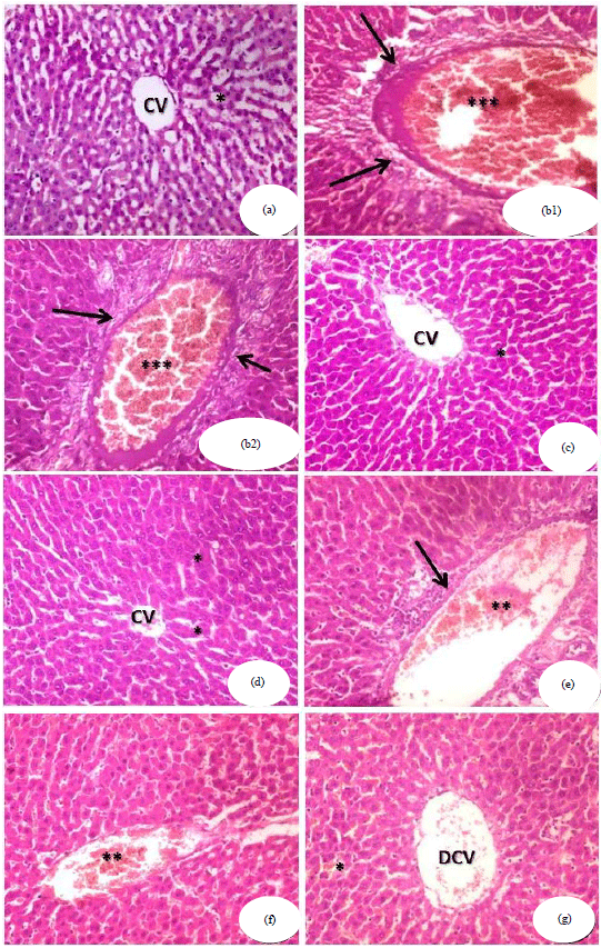 Image for - Protective and Antioxidant Role of Selenium Nanoparticles and Vitamin C Against Acrylamide Induced Hepatotoxicity in Male Mice