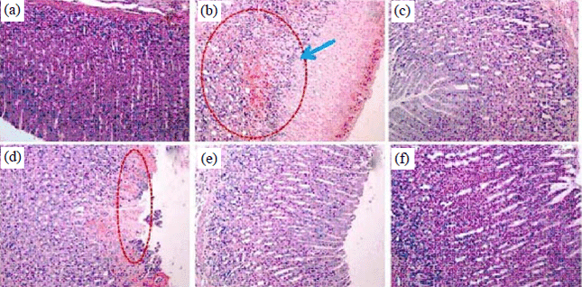 Image for - Gastroprotective Effects of Dracaena cochinchinensis (Lour.) Against Aspirin-Induced Gastric Ulcers in Rats