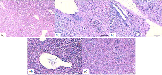 Image for - Ficus carica (Fig) Fruit Extract Attenuates CCl4-induced Hepatic Injury in Mice: A Histological and Immunohistochemical Study