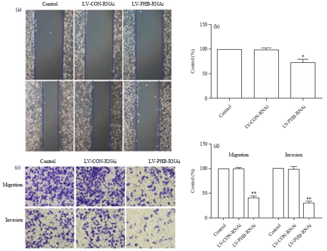 Image for - Celastrus Orbiculatus Extract Suppresses Migration and Invasionof Gastric Cancer by Inhibiting Prohibitin and c-Raf/ERK SignalingPathway