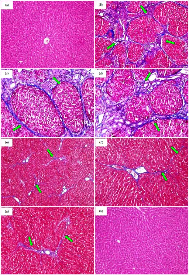 Image for - Effect of Basil Leaves Extract on Liver Fibrosis Induced by Thioacetamide in Male Rats