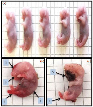 Image for - Deleterious Effects of Perinatal Exposure to Isotretinoin Drug on the Offspring of Pregnant Mice
