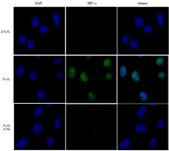Image for - Defensive Mechanism in Human Cholangiocarcinoma Cells Against Hypoxia by Cyanidin-3-glucoside Treatment