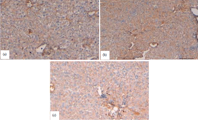 Image for - Ficus carica (Fig) Fruit Extract Attenuates CCl4-induced Hepatic Injury in Mice: A Histological and Immunohistochemical Study