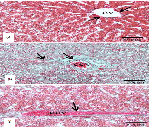 Image for - Aqueous Green Tea Extract and Prediction of Fibrosis in Lipopolysaccharide Intoxicated Rats