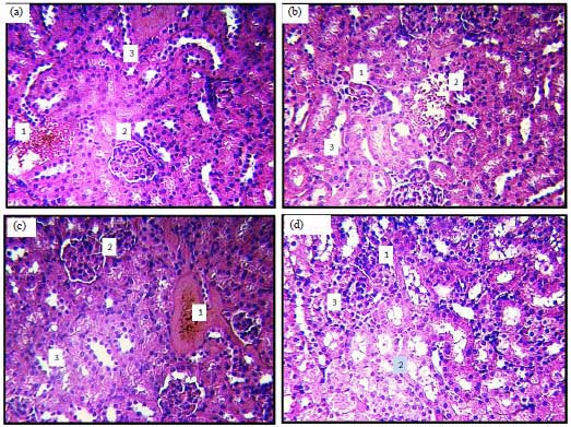 Image for - Histomorphological Changes in Mono-sodium Glutamate Induced Hepato-renal Toxicity in Mice