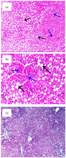 Image for - Camel Urotherapy and Hepatoprotective Effects Against Carbon Tetrachloride-induced Liver Toxicity
