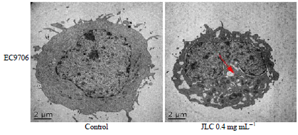 Image for - Mechanism of Jinlong Capsule (JLC) in Human Esophageal Squamous Cell Carcinoma (ESCC) via the MAPK Signal Pathway