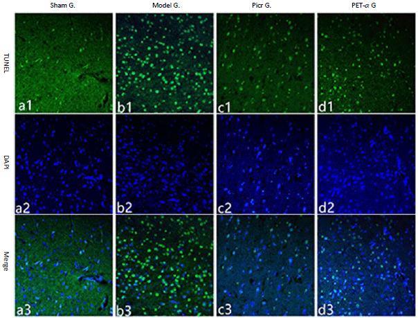 Image for - Neuroprotective Effects of Picroside II on Rats Following Cerebral Ischemia Reperfusion Injury by Inhibiting p53 Signaling Pathway