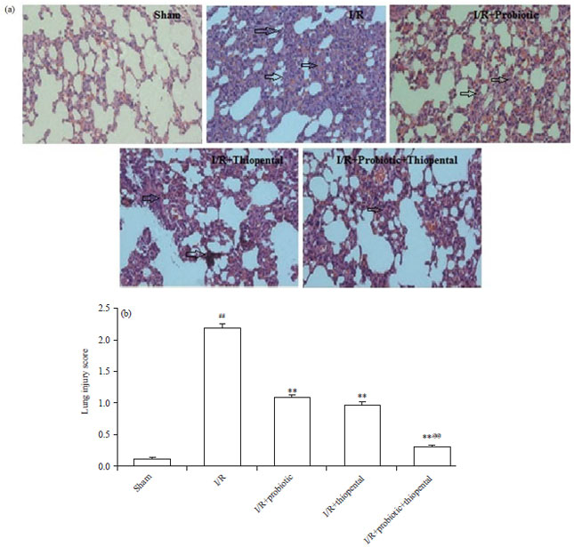 Image for - Protective Effect of Probiotic Potentiate with Thiopental in Intestinal Ischemia-Reperfusion Induced Lung Injury