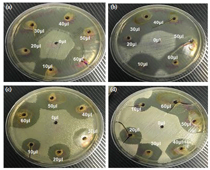 Image for - Alteration of Multi-drug Resistance Activities by Ethanolic Extracts of Nigella sativa Against Urinary Pathogens