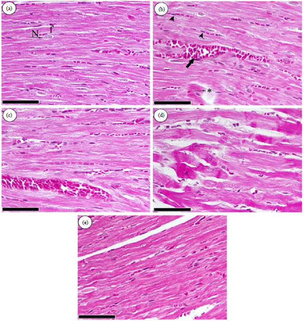 Image for - Losartan and/or Naringenin Ameliorates Doxorubicin Induced Cardiac, Hepatic and Renal Toxicities in Rats