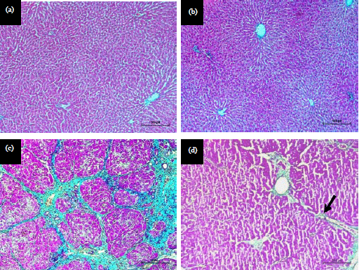 Image for - Phoenix dactylifera L. Extract Diminished Apoptotic Effect in Cirrhotic Liver of a Rat Model