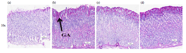 Image for - Acute Toxicity and Gastroprotective Effect of 2-pentadecanone in Ethanol-induced Gastric Mucosal Ulceration in Rats