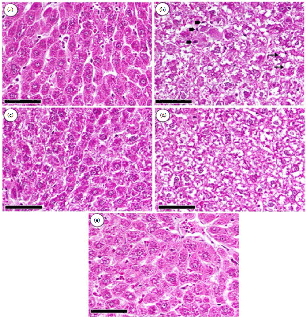 Image for - Losartan and/or Naringenin Ameliorates Doxorubicin Induced Cardiac, Hepatic and Renal Toxicities in Rats
