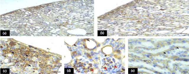Image for - Effect of Memantine Hydrochloride on Cisplatin-induced Toxicitywith Special Reference to Renal Alterations in Mice