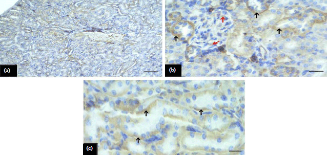 Image for - Effect of Memantine Hydrochloride on Cisplatin-induced Toxicitywith Special Reference to Renal Alterations in Mice