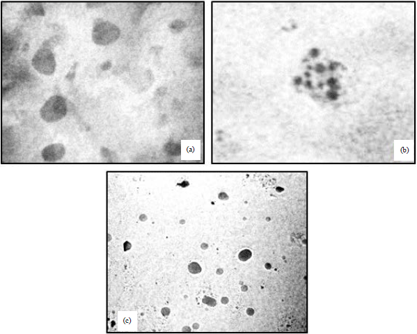 Image for - Synergistic Antitumor Activity of Doxorubicin and Atorvastatin Combination Loaded Nanoemulsion in Mice