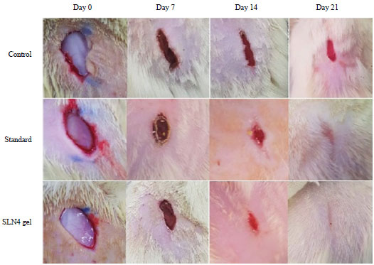 Image for - Development of Topical Antibacterial Gel Loaded with Cefadroxil Solid Lipid Nanoparticles: In vivo Wound Healing Activity and Epithelialization Study