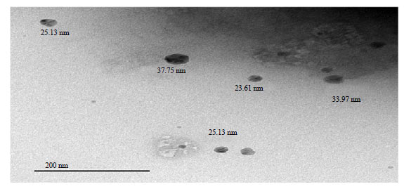 Image for - Ellagic Acid Loaded TPGS Micelles for Enhanced Anticancer Activities in Ovarian Cancer