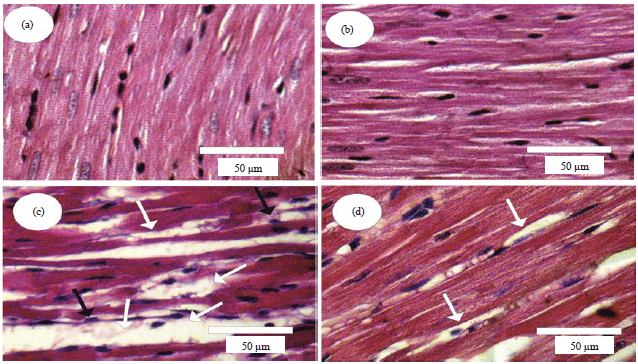 Image for - Beneficial Role of Rosemary Aqueous Extracts Against Boldenone Induced Cardiac Toxicity, Injury and Oxidative Stress, in Male Rats