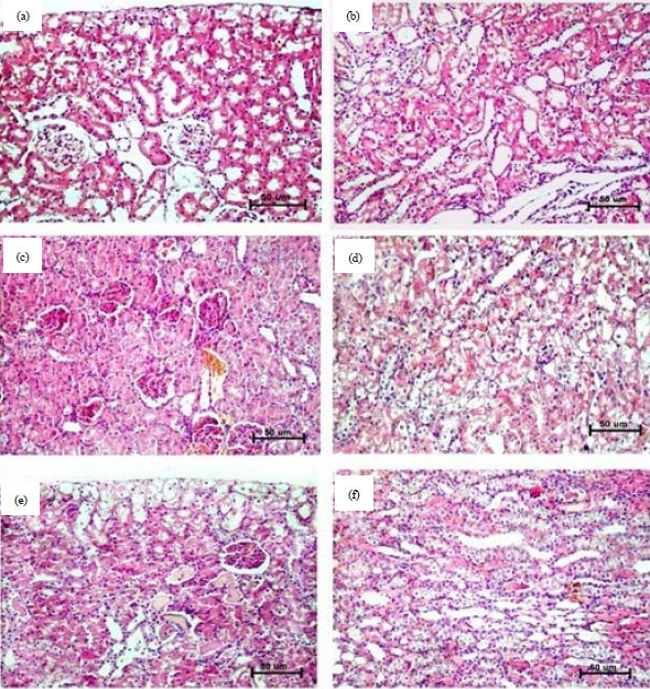 Image for - Camel Urine Prevents Cisplatin-induced Nephrotoxicity in Rats by Attenuating Oxidative Stress and Apoptosis