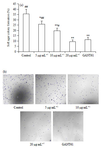 Image for - Scutellarin Protects against Human Colorectal Cancer in vitro by Down Regulation of Hedgehog Signaling Pathway Activity